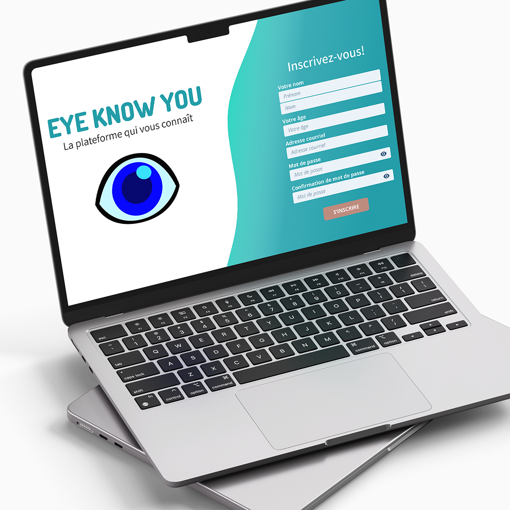 Eye